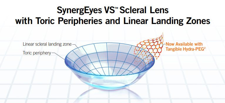 SynergEyes VS Scleral Lens